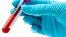 El cáncer de próstata preocupa a los panameños